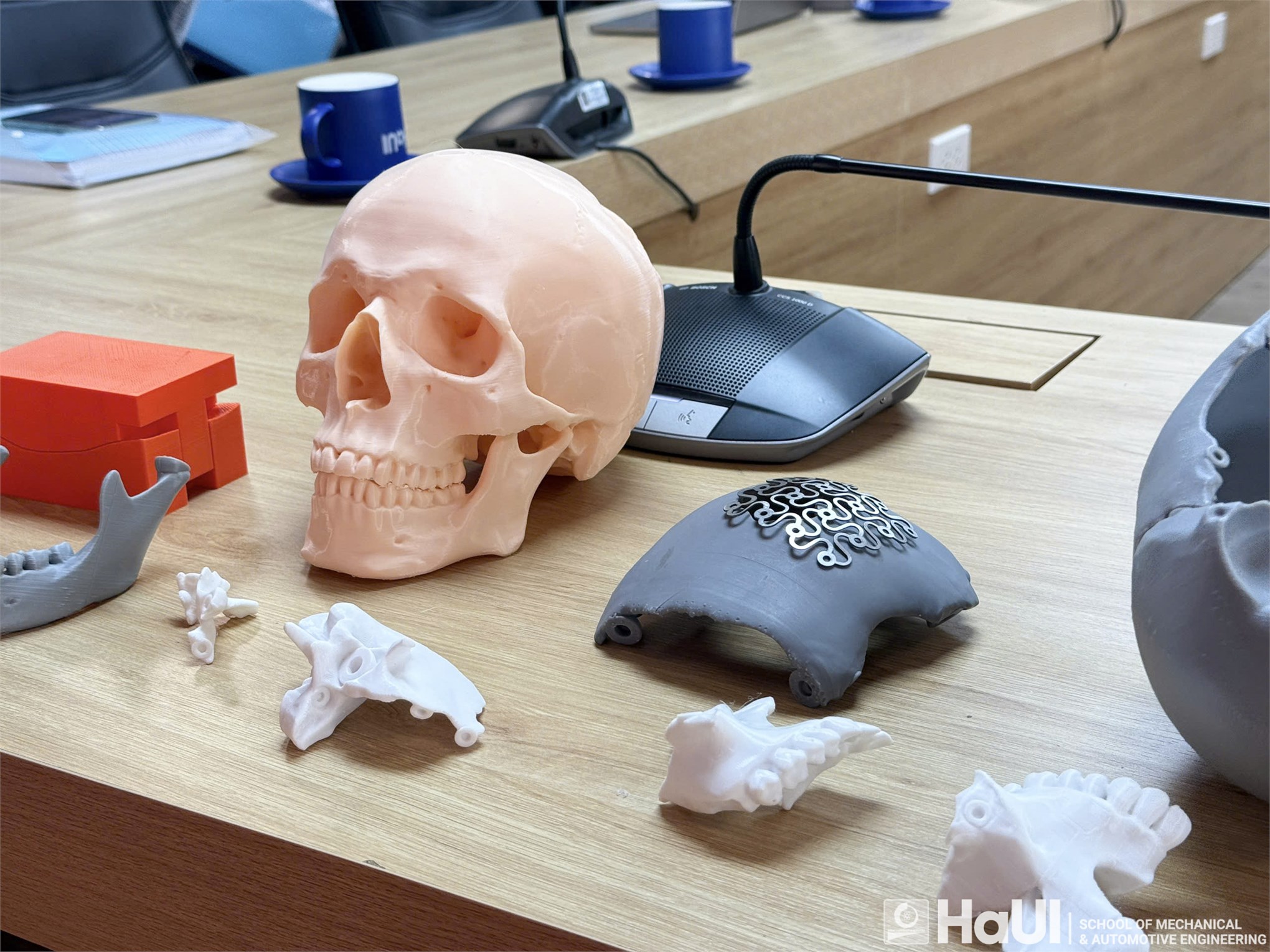 Nghiên cứu tối ưu hóa mảnh ghép xương sọ nhân tạo bằng công nghệ in 3D – hướng nghiên cứu mới tại Trường Cơ khí – Ô tô